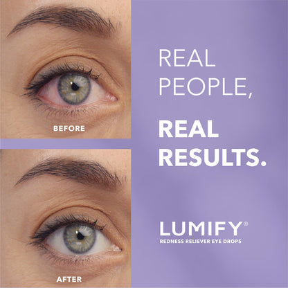 Lumify Redness Reliever Eye Drops, 0.08 fl oz